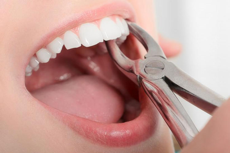 precise dental care blog